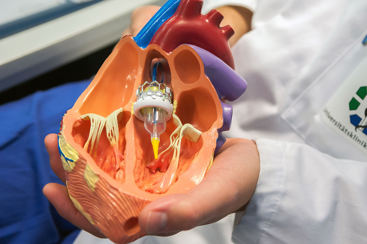 Koronarvaskuläre und strukturelle Herzerkrankungen - Titelbild