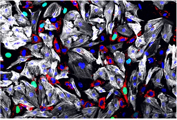 Translational Immunocardiology - Titelbild